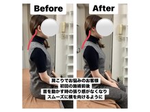 アンティオール 中目黒店/慢性的な肩こり改善整体