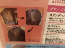 ストレスから解放＊癒しのひとときをご提供[頭皮ケア/北浦和]