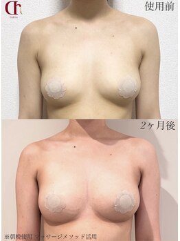 キャニー(cany)/お家で毎日〇〇塗っただけ！？