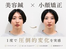 リノ ショウナン(LINO SHONAN)
