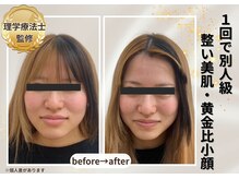 小顔美肌ファクトリー 梅田院の雰囲気（男性にも人気！男性セラピスト在籍。印象・清潔感・肌質UP!）