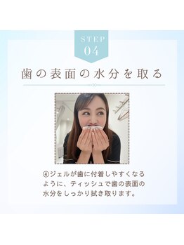 ホワイトニングショップ 奈良香芝店(Whitening shop)/セルフホワイトニング手順4