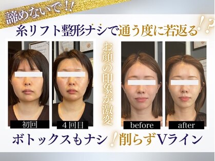 ユウェール(JUWEEL)の写真