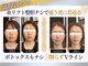 ユウェール(JUWEEL)の写真