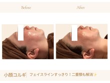 アランルージュ(ALANROUGE)/劇的★ビフォーアフター