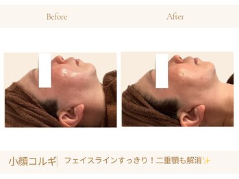 アランルージュ(ALANROUGE)/劇的★ビフォーアフター