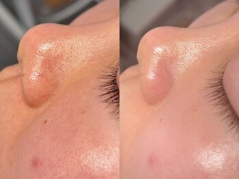 ルーナジェーナ(Luna llena)/池袋　エステ　ルーナジェーナ