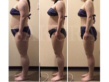 エステティックサロン サクラ(SAKURA)の雰囲気（セルライトゼロ&/骨盤バランス、耳ツボ　６ヶ月で-15キロ）