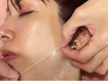 リズ ボーテの写真/郡山希少『糸を肌に乗せる』最新◇コラーゲン系「リフトアップ」でフェイスラインのたるみをスッキリ改善♪