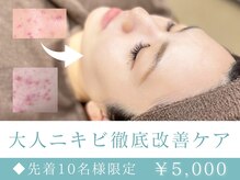 フェイシャル専門店 エピア 掛川店(Epia)