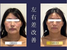 エレミュー 烏丸(Elemue.)/40代　《歪み改善》《左右差》