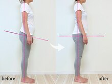 エーアール(AR)/【Before/After】　