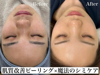 リベルキョウト 京都駅前店(Liber Kyoto)/魔法のシミケア