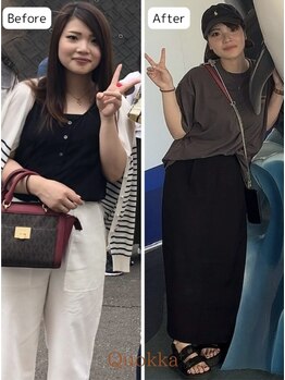 【脱毛・よもぎ蒸しサロン】Quokka/よもぎ蒸し