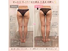 トータルビューティ リライフ(Total beauty Relife)の雰囲気（毛穴なくしたいならセルマンで植物由来でもしっかり肌育セルマン）