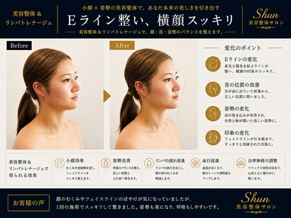 リストアハート(Restore Heart)の写真