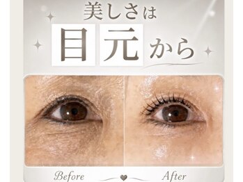 ラフィーユ 南風原店(Lafille)の写真/アイパワーエステで目元の悩み解消！くま・たるみ・くすみ・眼精疲労もスッキリ◎