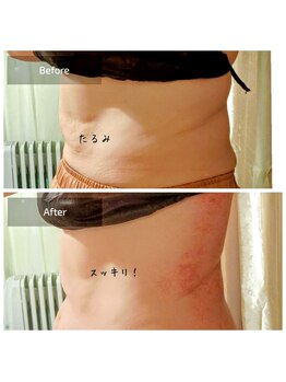 わたしのネイルとよもぎ蒸し/