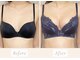 ノルン(Norn)の写真/子胸/年齢による下垂/授乳後の萎み/左右差など改善!ハンド×高性能マシーンでふっくらハリのあるバストへ☆