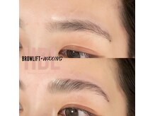 シュエット(Chouette)/ハリウッドブロウリフト