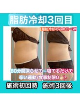 ビューティ ウィッチ(Beauty Witch)/痩身エステは【甘え】ではない！