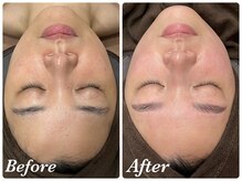 ミランオオサカ(MIRAN OSAKA)/ビフォーアフター