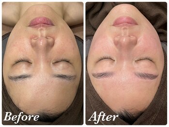 ミランオオサカ(MIRAN OSAKA)/ビフォーアフター