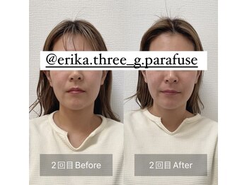 スリージー/before/after