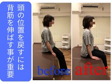 広島ミライエ整体院(広島MIRAIE整体院)/背中が丸くなる事での肩の痛み