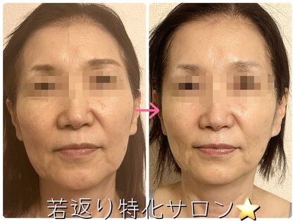トルル(Tlulu)の写真