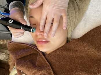 トウキョウビューティーラボ(TOKYO BEAUTY LABO.)/ハイドラフェイシャル施術写真