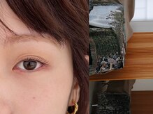 ネストアイ(NEST eye)