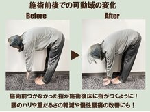 施術前後での可動域の変化【茗荷谷/文京区/後楽園/新大塚】