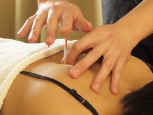 イズミ整骨院 大泉院の雰囲気(40代~人気の東洋医学による鍼灸メニュー)