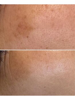 ソリシア(SORISIA)/