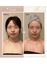 リングケー(Ling K)/小顔コルギ