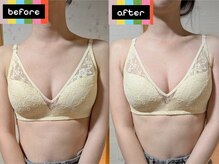 スノードロップ(snowdrop)/20代前半の方