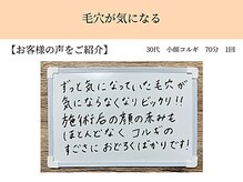 ペルク(perk)/何年も前から毛穴がお悩み