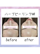 シャルム ココ 八尾店(Charme coco)/ツヤ＆透明感アップ！！