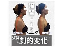 小顔フェイスラボ 岡崎店(小顔 Face Labo.)の雰囲気（整体コルギで肩こり&首コリ解消しながら、猫背・巻き肩も改善◎）