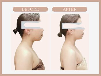 スリムライン 秋田店(The Slim Line)/before→after