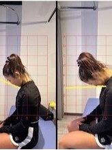 ビーワイ鍼灸整骨院 心斎橋院/before&after