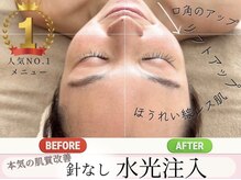 マヴィ 藤井寺店(MavY.)/最先端美容　針なし水光注入