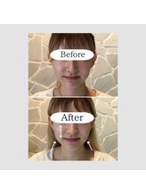 ウナ デ リンゴル 恵比寿店(UNA de Ringol)/大人気小顔ドーリーフェイス