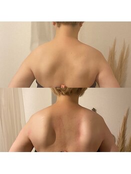 ソバニ(SOBANI)/肩甲骨周りをほぐして背中美人へ