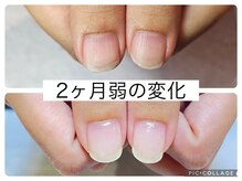 アンドネイル 海老名(&nail)/自爪育成ジェルコース　2回目