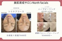 ノースフェイシャルズ(North facials)
