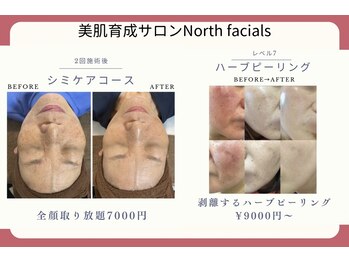 ノースフェイシャルズ(North facials)