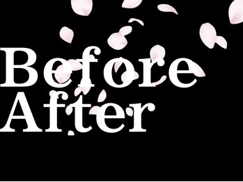 サクラ(SAKURA)/本厚木/フェイシャル/シミ