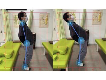 整骨院こころ 祇園院/可動域の変化